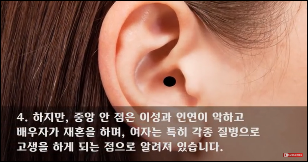 귀에 이런 점이 있으면 절대 빼지 마라!! (영상) | Snsfeed 제휴콘텐츠 제공 '실시간 핫이슈'