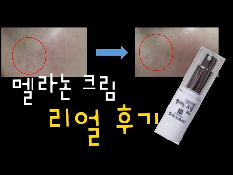 의약품 미백크림 , 멜라논 크림 리얼 후기 영상 - Youtube